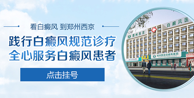 郑州西京白癜风医院